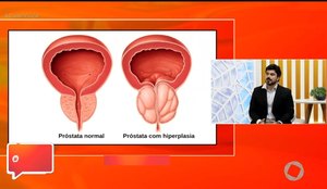 Urologista esclarece dúvidas sobre câncer de próstata no programa 'Com Você'