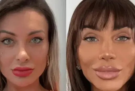 Cirurgia que altera cor do olho tem uso restrito para pessoas cegas