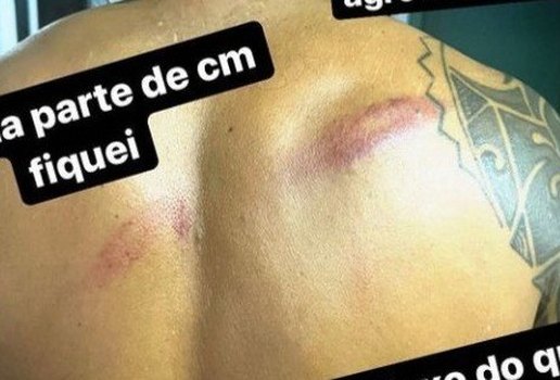 Vereador denunciou a agressão nas redes sociais