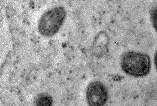 Registradas imagens de replicação do vírus monkeypox em célula