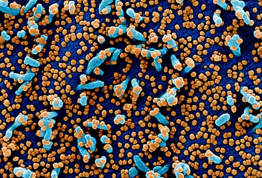 Coronavirus matando celulas 2