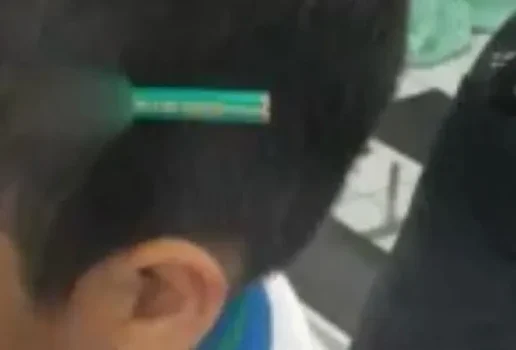 Estudante finca lapis na cabeca de colega durante briga em escola