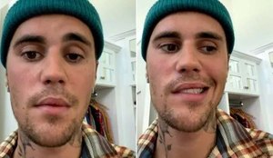 Justin Bieber pede orações após ter rosto paralisado; saiba mais