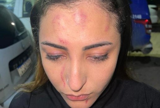 Soraya Oliveira, de 23 anos, foi agredida momentos antes de uma apresentação