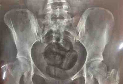 Foto 257 raio x