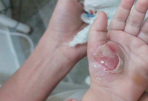 Mulher e presa por suspeita de espancar o proprio filho de um ano no Brejo paraibano