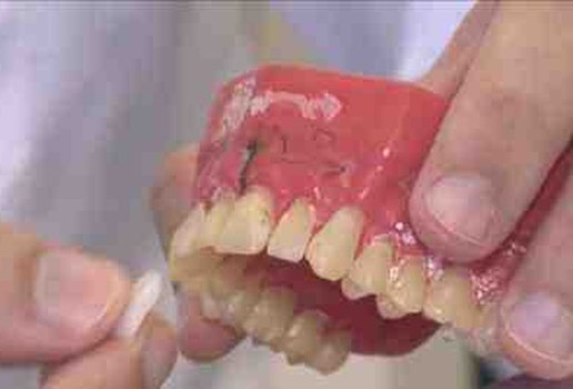 Lenter de contato dental