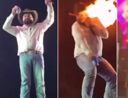 Sertanejo mostra como ficou seu rosto apos ser queimado em show