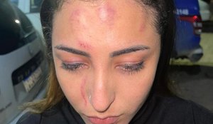 Soraya Oliveira, de 23 anos, foi agredida momentos antes de uma apresentação