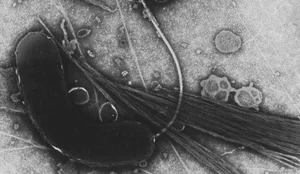 Vibrio cholerae colera caso confirmado