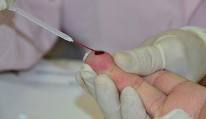 João Pessoa inicia programação contra hepatites virais nesta quarta (12)
