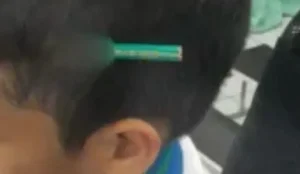 Estudante finca lapis na cabeca de colega durante briga em escola