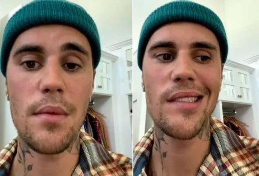 Justin Bieber pede orações após ter rosto paralisado; saiba mais