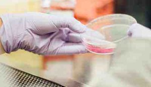 Cientistas descobrem segunda mutacao genetica resistente ao HIV