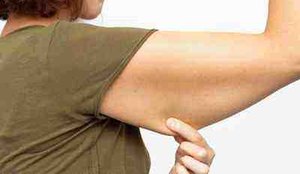 As principais causas da flacidez nos bracos e saiba como trata la