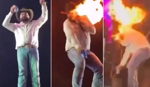 Sertanejo mostra como ficou seu rosto apos ser queimado em show