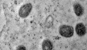 Registradas imagens de replicação do vírus monkeypox em célula
