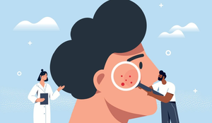 O câncer de pele é uma doença silenciosa e agressiva (Imagem: mentalmind | Shutterstock)