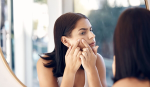 A acne na vida adulta é comum e pode ser tratada com cuidados específicos (Imagem: PeopleImages.com - Yuri A | Shutterstock)
