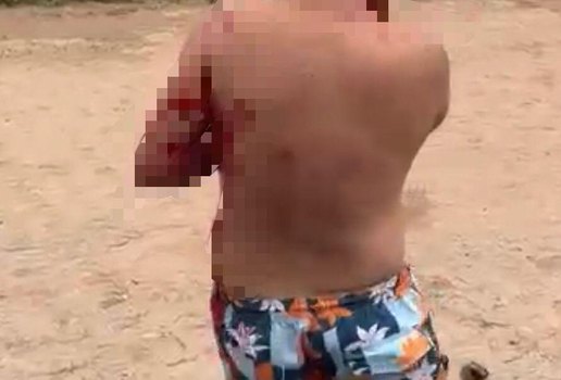 Policial Penal foi socorrido ao Trauminha, em Mangabeira