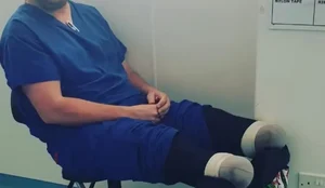 Cirurgiao amputou as proprias pernas para receber indenizacao milionaria