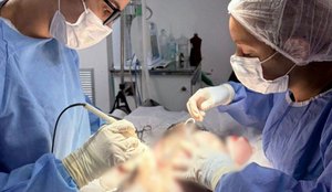 Secupa cancer de mama animal 3 880x1024