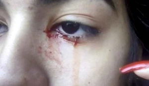 Adolescente chora sangue e intriga medicos no interior de Sao Paulo