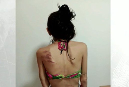 Vitima tortura