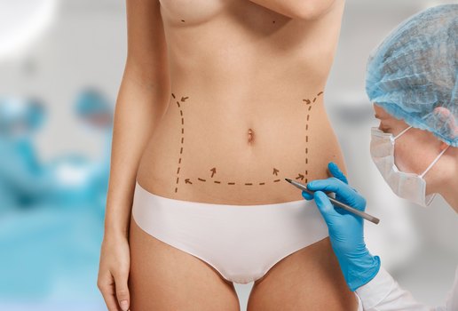 Woman marked out for cosmetic surgery