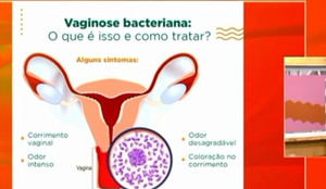 Mais de 2 milhões de mulheres no Brasil são afetadas todos os anos