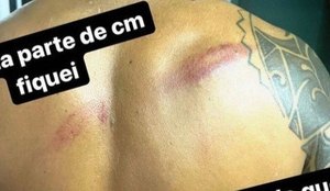 Vereador denunciou a agressão nas redes sociais