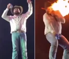 Sertanejo mostra como ficou seu rosto apos ser queimado em show