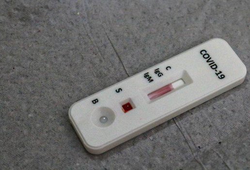 Testes rápidos de HIV e dengue poderão ser feitos em farmácias