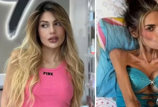Influencer morre aos 30 anos apos luta contra disturbio alimentar