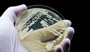 Ameba comedora de cerebros