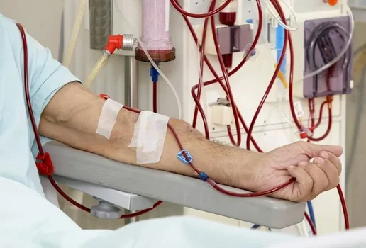 Hemodialise