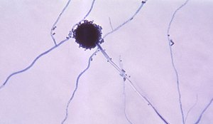 Substância contra fungo causador de infecções respiratórias é criada na UFPB