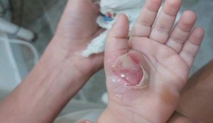 Mulher e presa por suspeita de espancar o proprio filho de um ano no Brejo paraibano