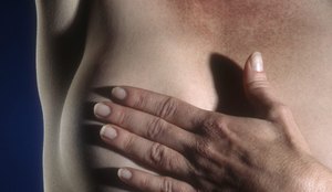 Câncer de mama é causa de maior mortalidade entre as mulheres