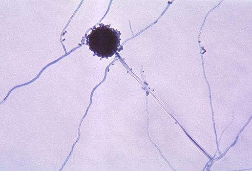 Substância contra fungo causador de infecções respiratórias é criada na UFPB